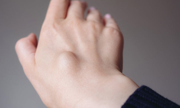 Ganglion