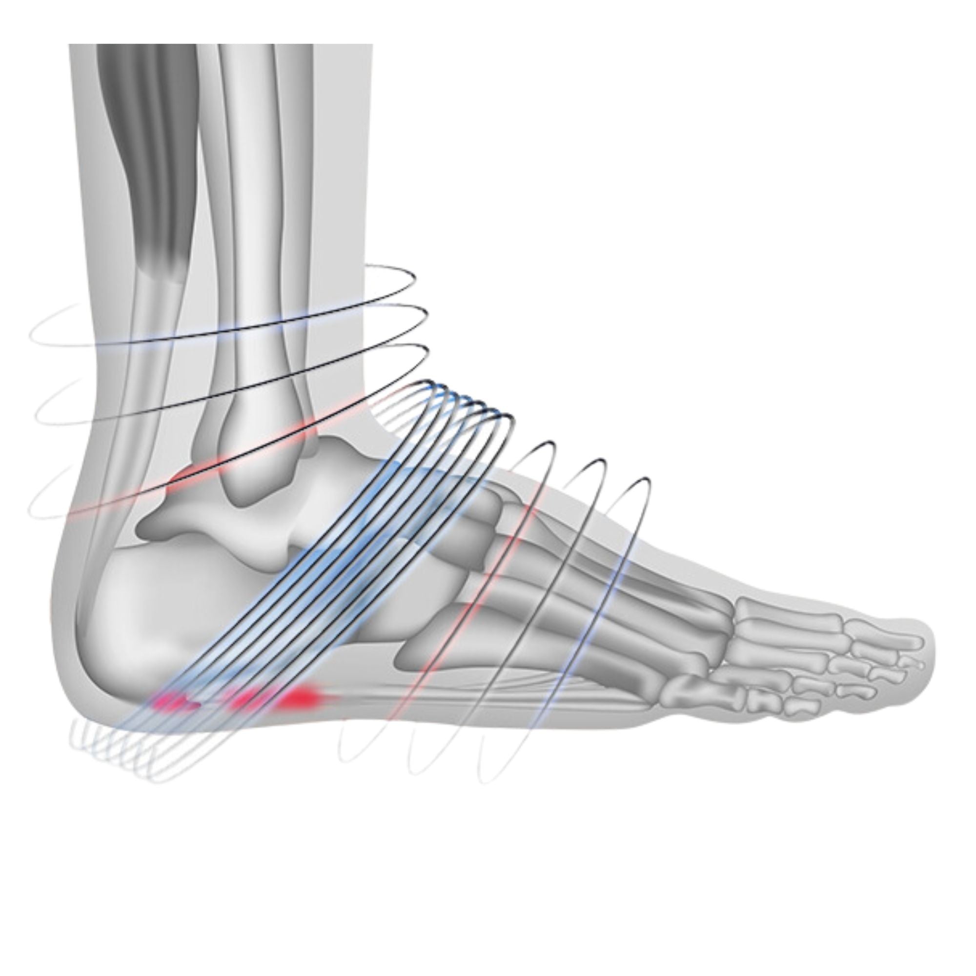 Kompressionsstrümpfe PF8 für Plantarfasziitis und Fersensporn