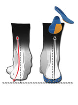 Insole MOW for pronation support and stabilization